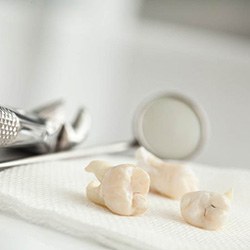 three extracted teeth next to dental tools